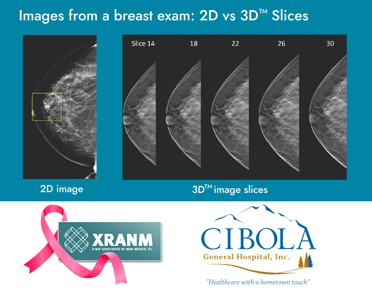 Advanced, Modern Radiology & Medical Imaging in Grants, NM