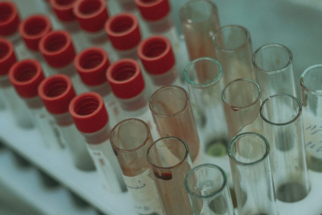 Labratory Tubes